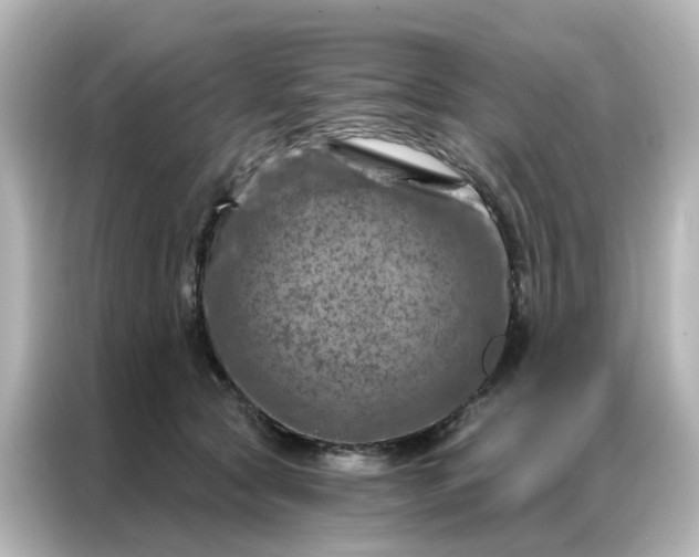 X0000087000561200704301400