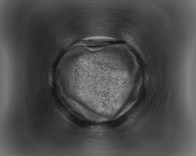 X0000087000259200705071512