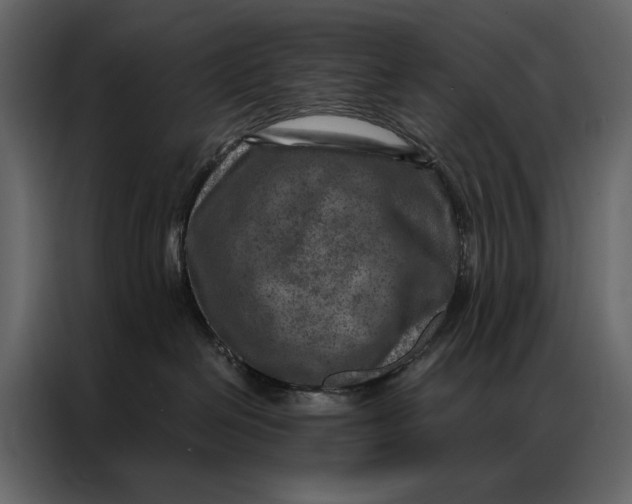 X0000087000286200705071512