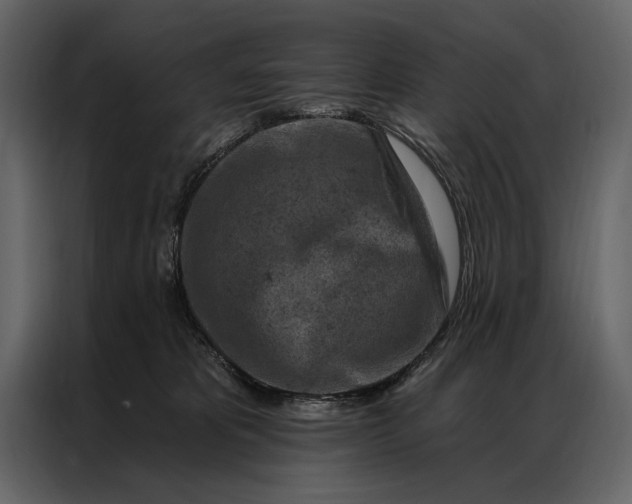 X0000087000325200705071511