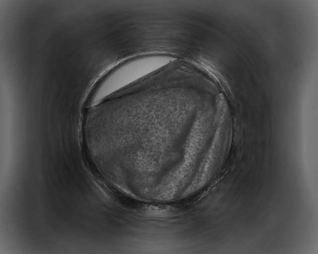 X0000087000346200705071510