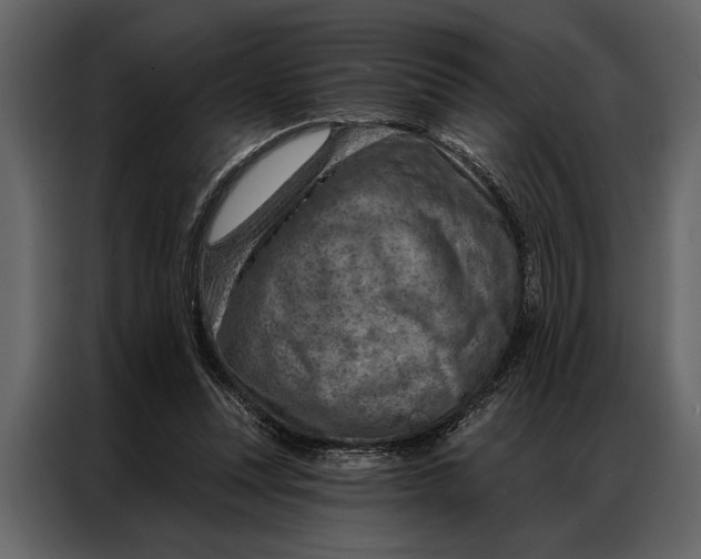 X0000087000351200705071510