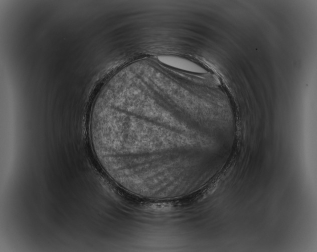 X0000087000353200705071510