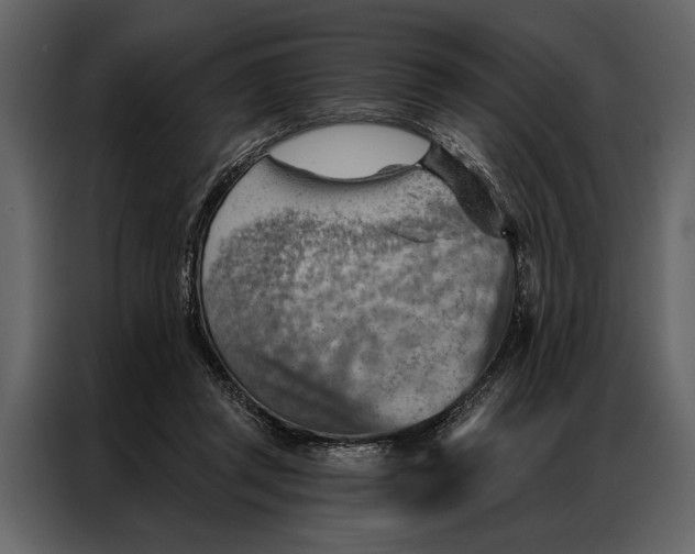 X0000087000357200705071510