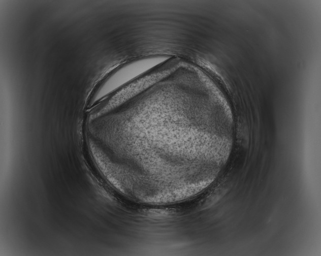 X0000087000394200705071510