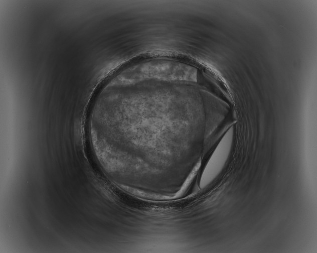 X0000087000487200705071509