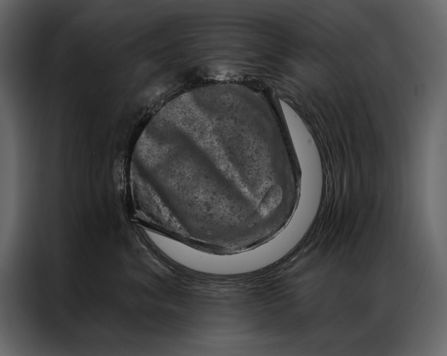 X0000087000620200705071507