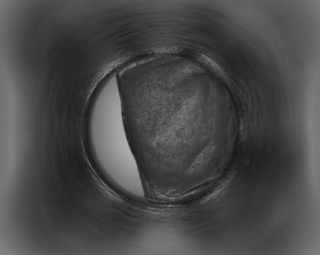 X0000087000725200705071505