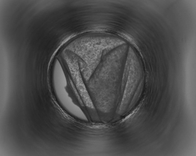 X0000087000835200705071504