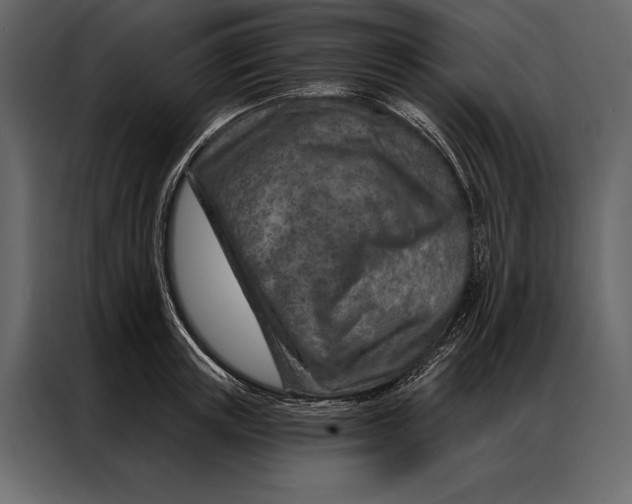 X0000087000851200705071504