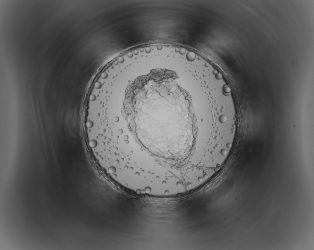 X0000087000856200705071504