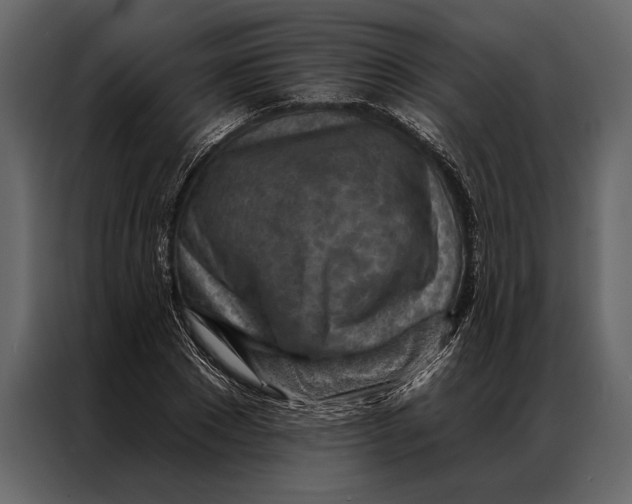 X0000087000881200705071504