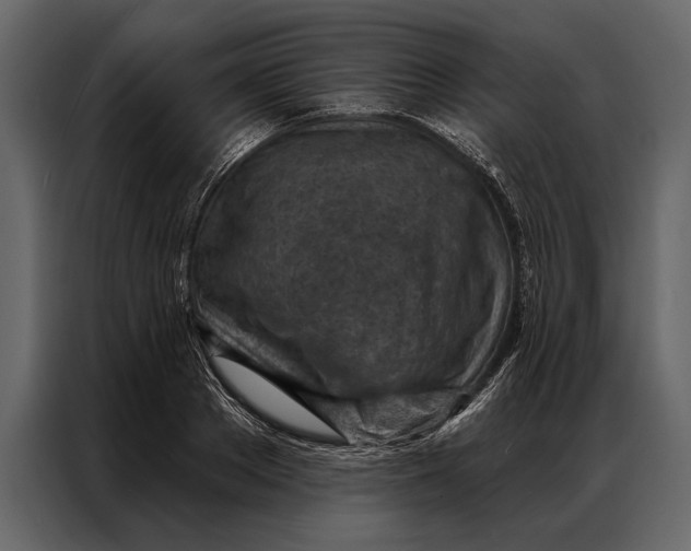 X0000087000889200705071504