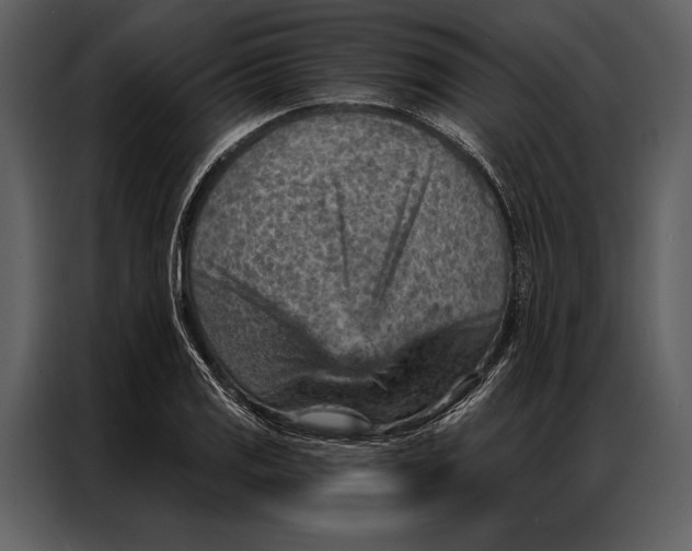 X0000087001125200705071500