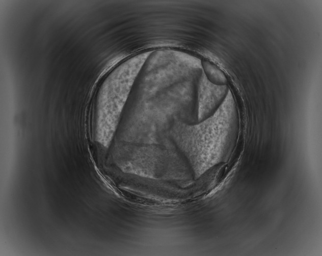 X0000087001137200705071501