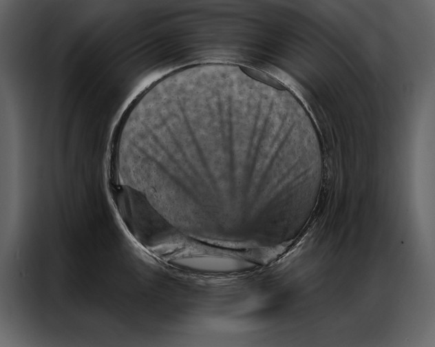 X0000087001147200705071501