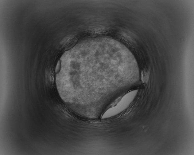 X0000087001155200705071500