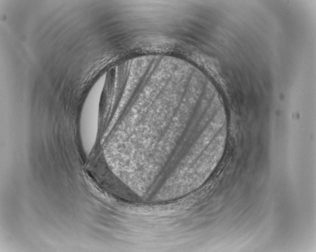 X0000087000017200705141817