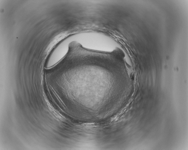 X0000087000054200705141816