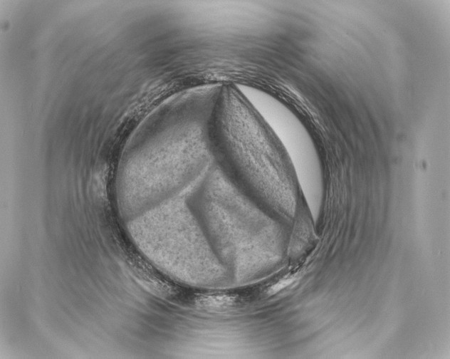 X0000087000217200705141814