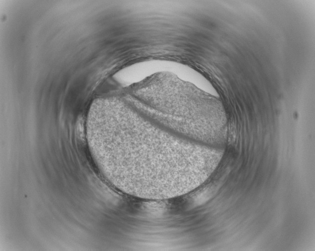 X0000087000238200705141814