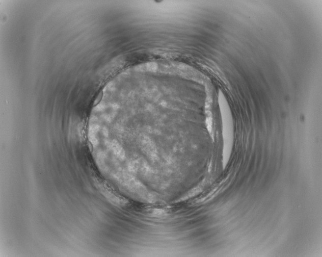 X0000087000285200705141814