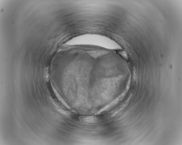 X0000087000383200705141812