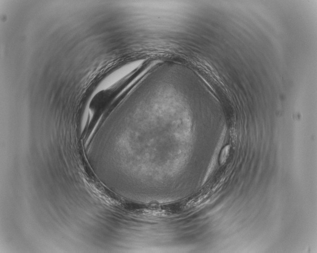 X0000087000458200705141810
