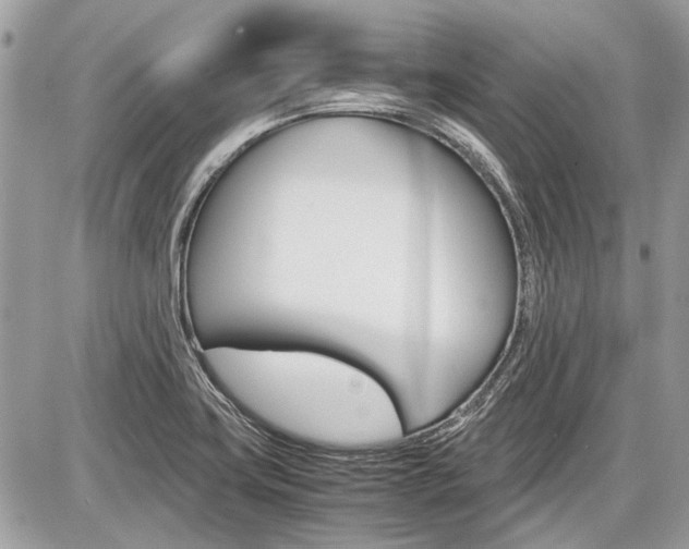 X0000087011419200704161254