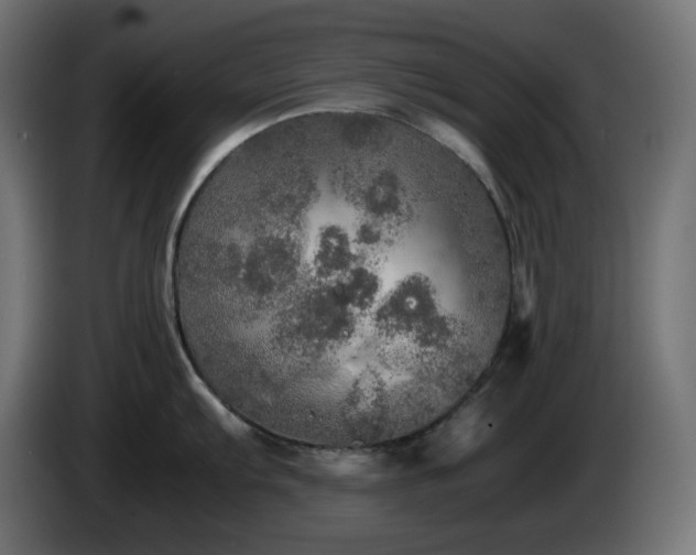 X0000087011103200704161537