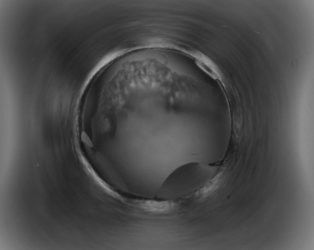 X0000087011142200704161537