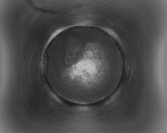 X0000087011230200704161536