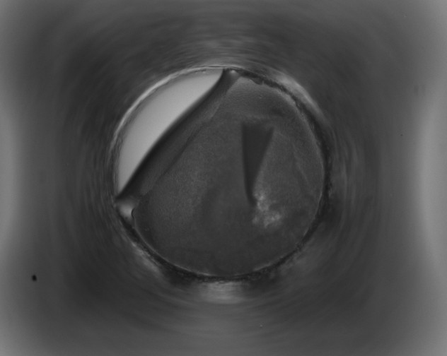 X0000087011268200704161535