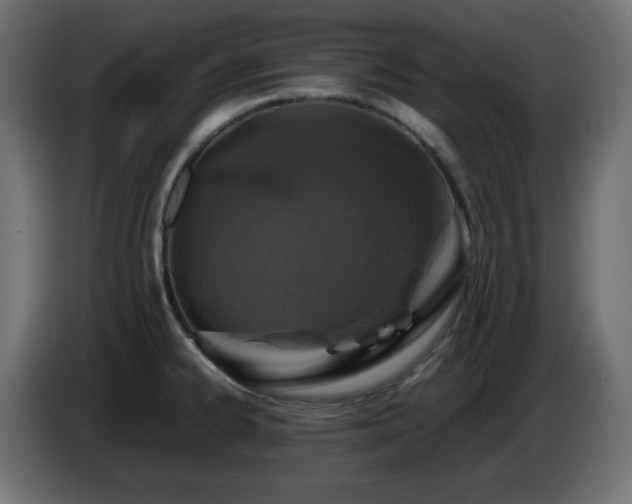 X0000087011334200704161535