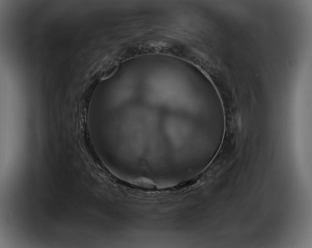 X0000087011397200704161533