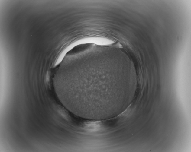 X0000087010132200704301425