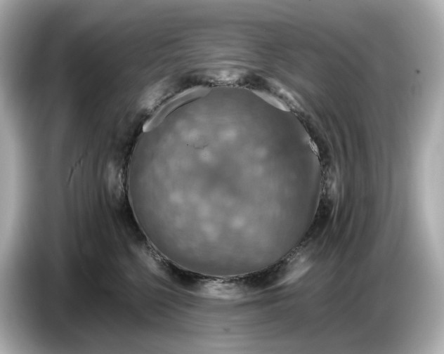 X0000087010568200704301420