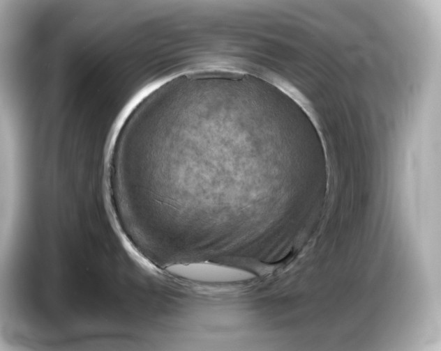 X0000087011152200704301413