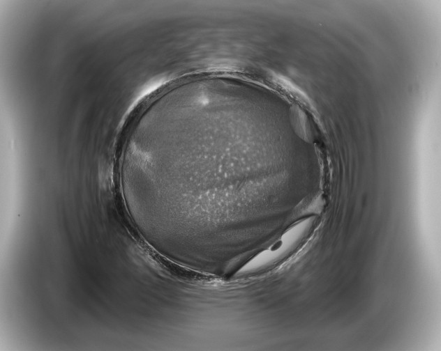 X0000087011166200704301412