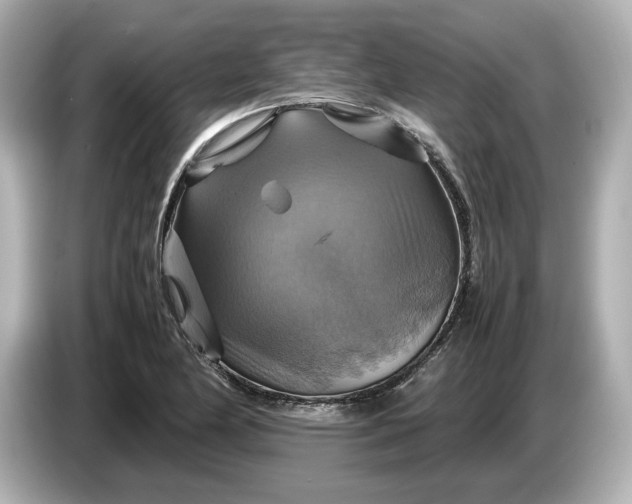 X0000087011174200704301412