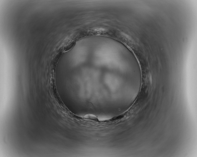 X0000087011397200704301408
