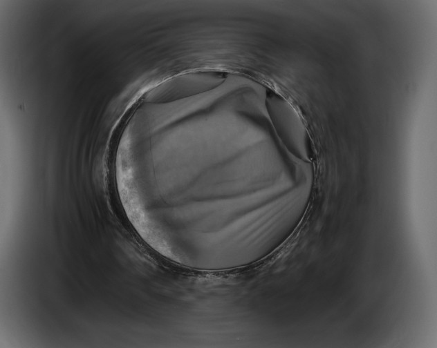 X0000087010290200705071531