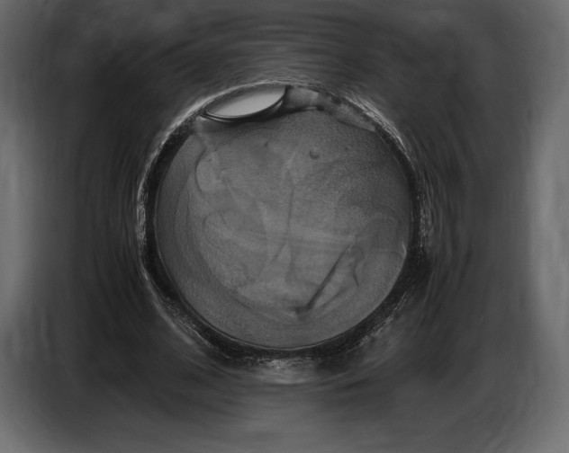 X0000087010584200705071527