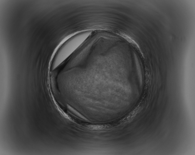 X0000087010792200705071525