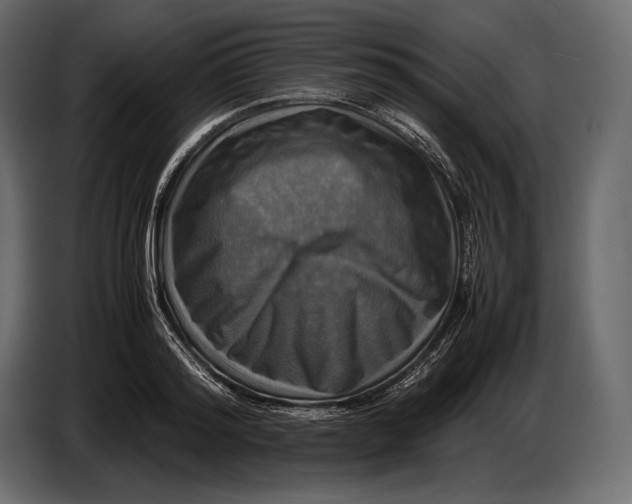 X0000087010796200705071525