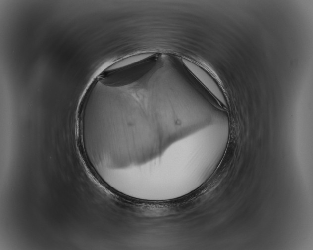 X0000087011095200705071521