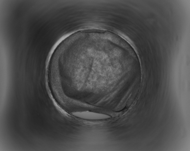 X0000087011152200705071521