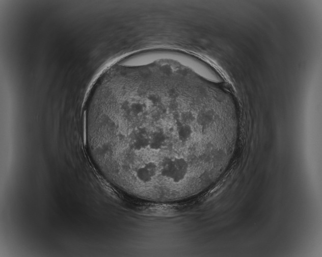 X0000087011175200705071520