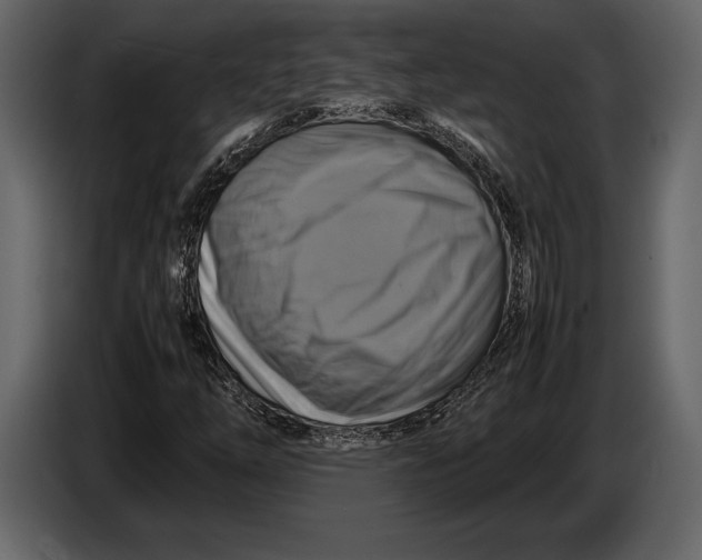 X0000087011254200705071519