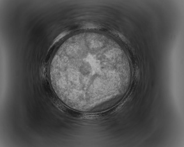 X0000087011258200705071519